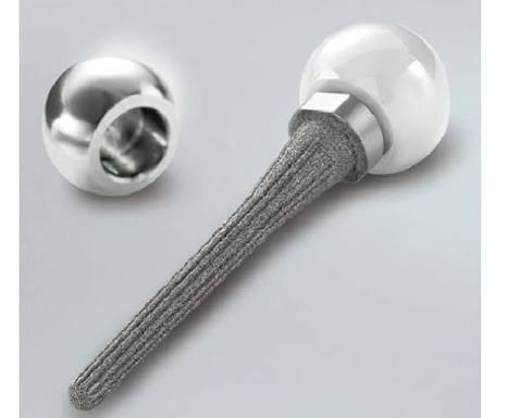 Herbert ulnar head prosthesis